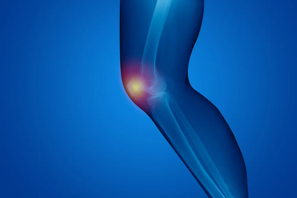 Mini-Posterior Hip Replacement Glendale AZ