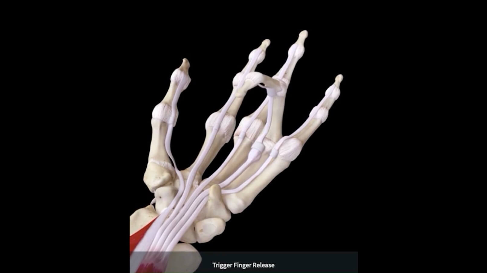 Trigger Finger TREATMENT