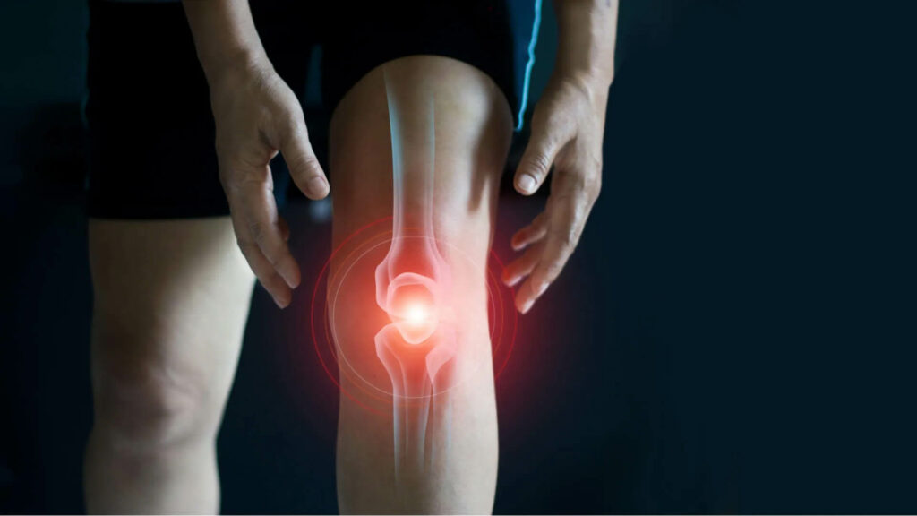 knee arthritis