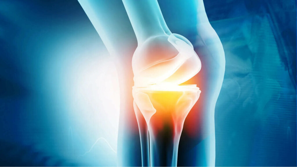 Mini-Posterior Hip Replacement Glendale AZ