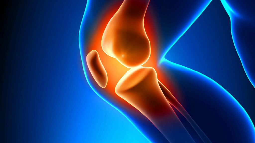 patella pain